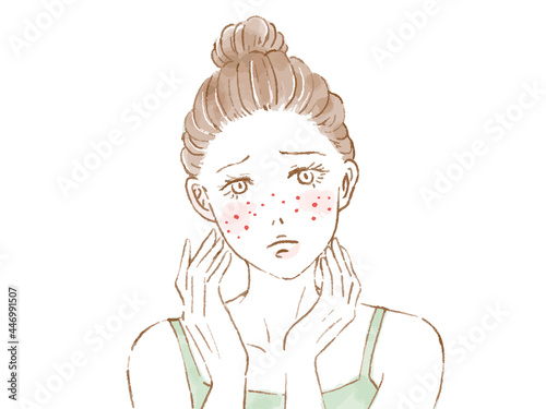 ニキビに悩む女性