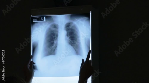 x-ray image of a person's lungs