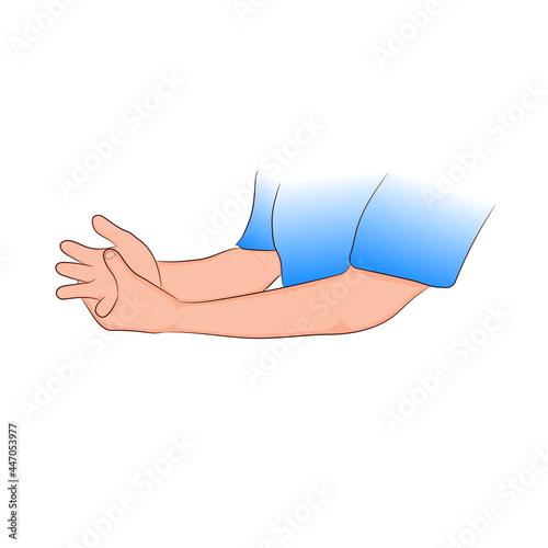 image graphics Guillain-Barre syndrome Wrist pain is often caused or ascending paralysis  by sprains concept healthcare vector illustration