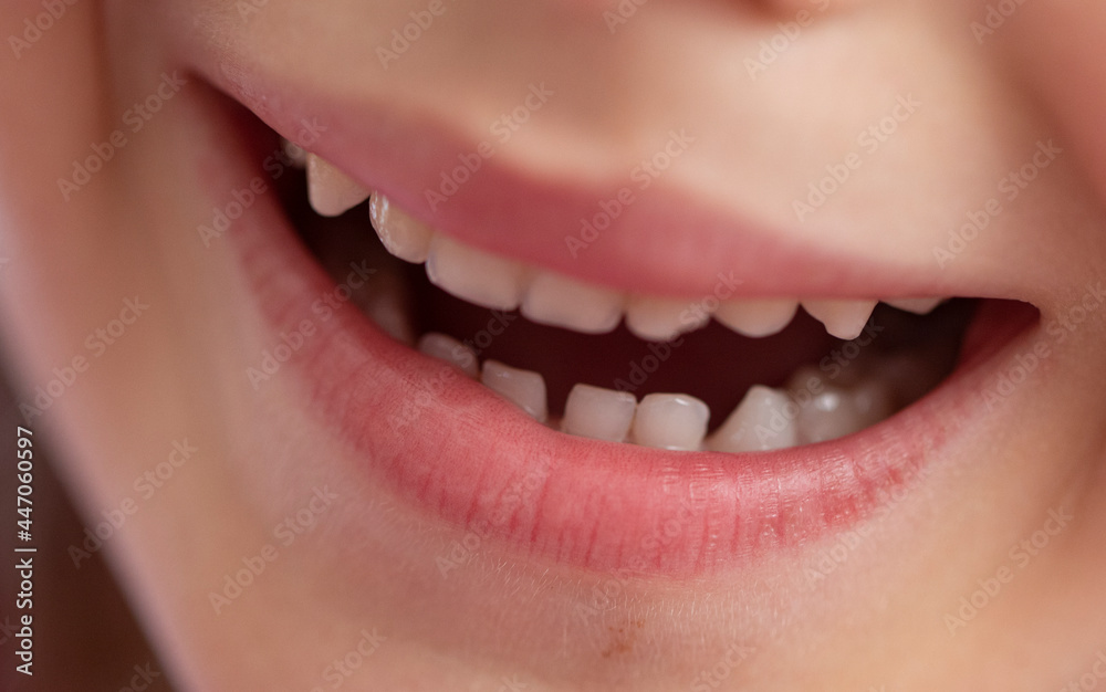 Kids smile. Smiling kids face. Child. Kids smile. Smiling kids face. Child.