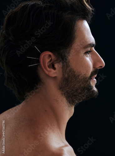 Fotografie Handsome man having ear acupuncture for diseases treatment, over black background, side view