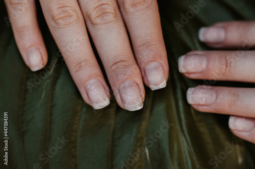 Foto Close up woman nails after bad manicure on the background of a green leaf