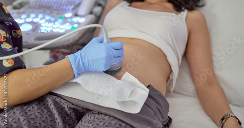 hand of a doctor with an ultrasound on the belly of a pregnant woman doing a control ultrasound in a clinic photo