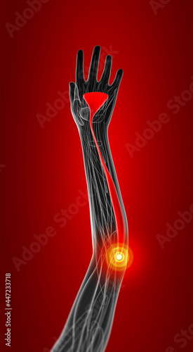 3d rendering medical  illustration of the palmaris longus photo