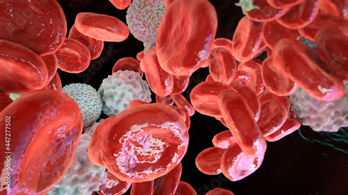 Polycythemia, an increase in the number of red blood cells in the body photo
