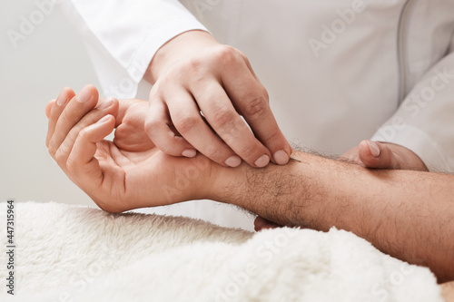 Reflexologist insert acupuncture needle into a patient's hand. Acupuncture treatment, reflexology, alternative medicine