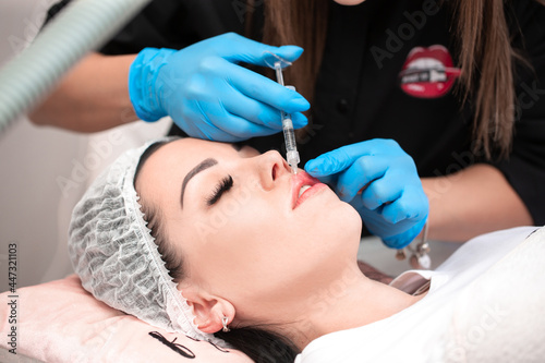 Lip augmentation. Beautician injects hyaluronic acid into the lips of a girl with a syringe. The cosmetologist doctor performs the procedure in the cosmetology office. Plastic surgery.