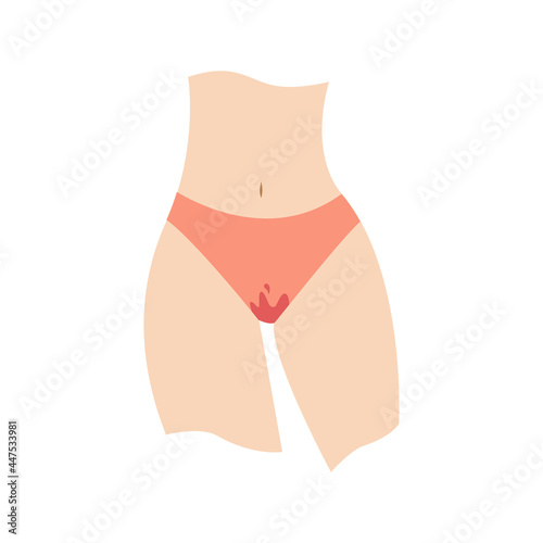 Body of woman wearing blood-stained panties. Period cramps, menstruation, feminine hygiene concepts. For topics like critical days, premenstrual syndrome, underwear