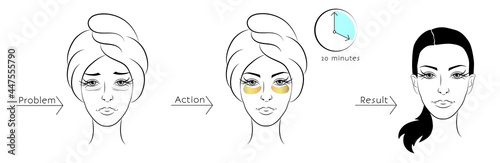 Cosmetic effect of eye patches. Skin problem and its solution with patches. A woman takes care of her skin. Linear vector illustration isolated on white background.