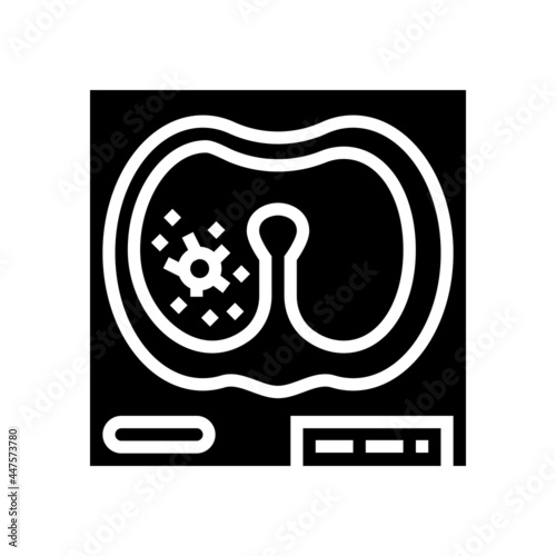 lung mucormycosis glyph icon vector. lung mucormycosis sign. isolated contour symbol black illustration
