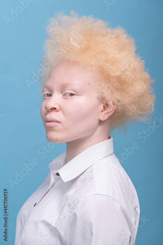 Studio portrait of albino woman in white shirt photo