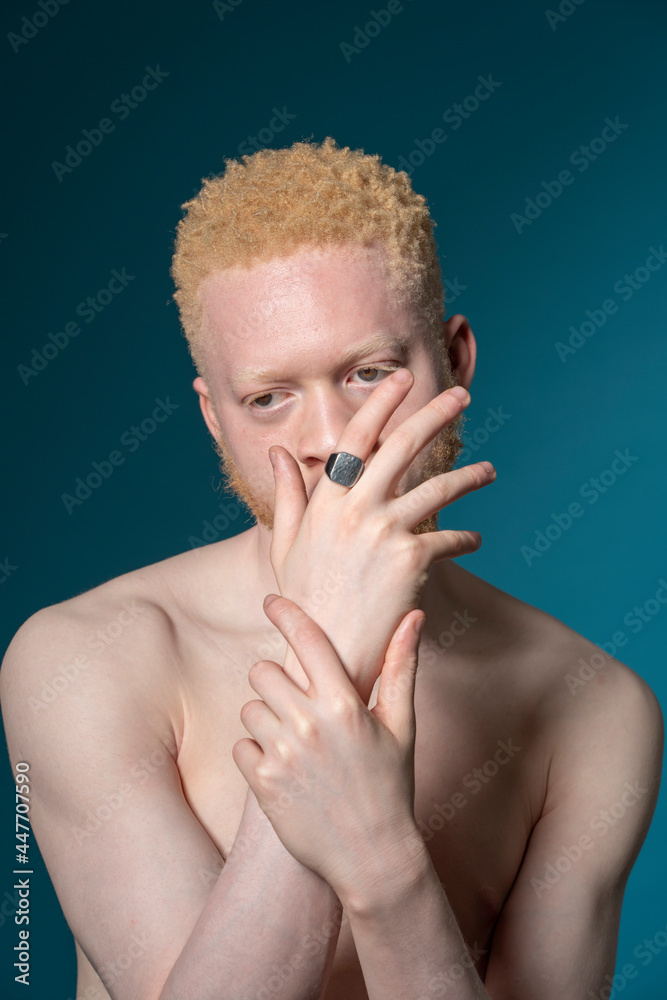Studio portrait of shirtless albino man Stock Photo Adobe Stock