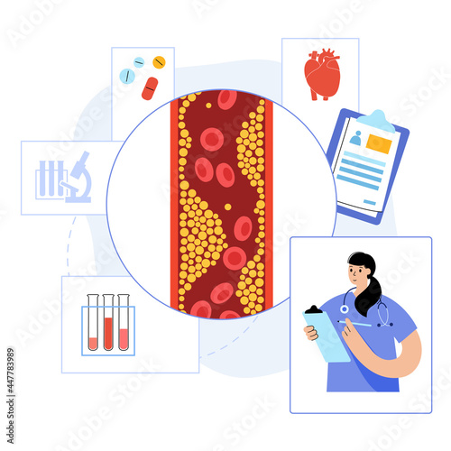 Cholesterol heart disease