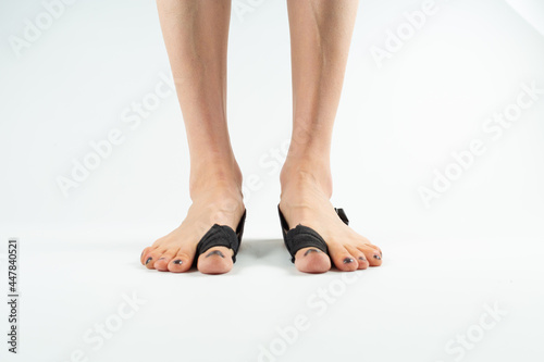  stabilizing orthosis for the correction of the big toe on the woman legs when hallux valgus, 2 legs, close-up isolated, white background
