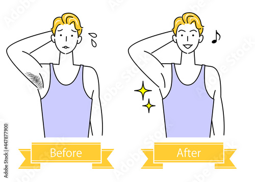 ムダ毛処理 わき毛を脱毛する可愛い男性のビフォーアフター イラスト シンプル ベクター