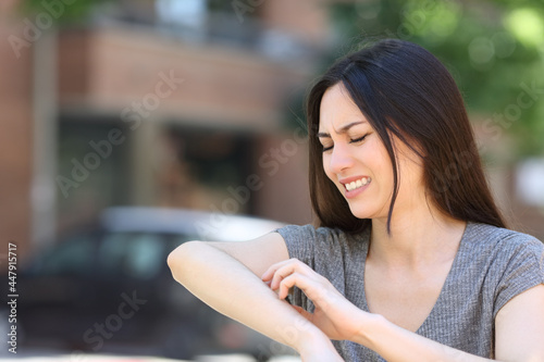 Asian woman scratching itchy arm in the street photo
