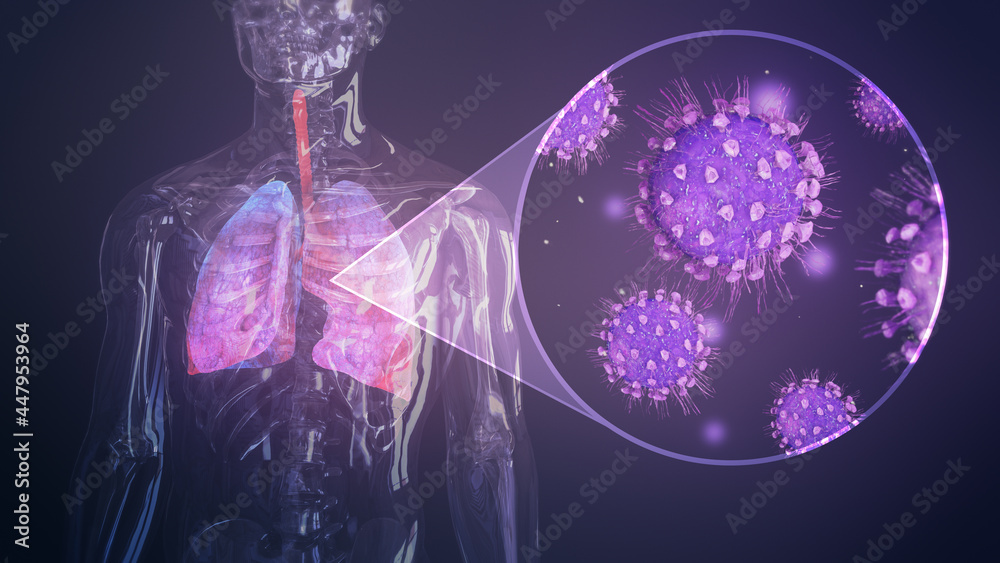 Respiratory disease inside lungs. Pneumonia. Influenza type virus