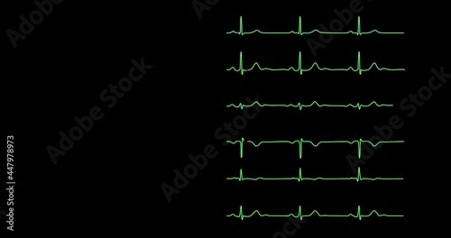 herzfrequenz hirnwellen ekg eeg herzschlag   elektroenzephalografie cardiogram oscilloscope close-up health monitoring 4k  