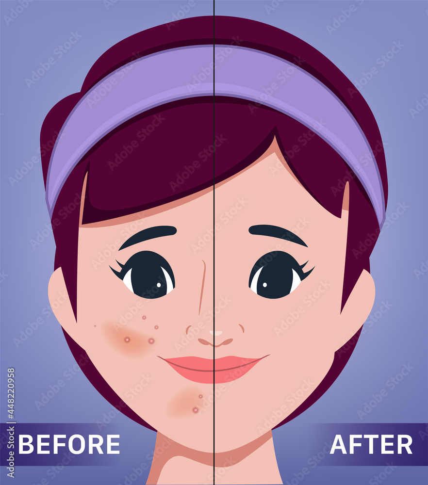 Fototapeta premium The young female face. Acne and clean skin. the portrait of beautiful woman surgery clinic.