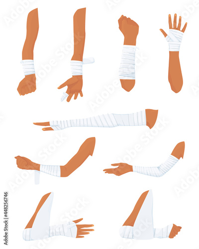 a set of bandaged hands in different positions. bandaging process. medical bandages. fractures and cuts on the hands. hands in bandages. vector flat isolated on white background.