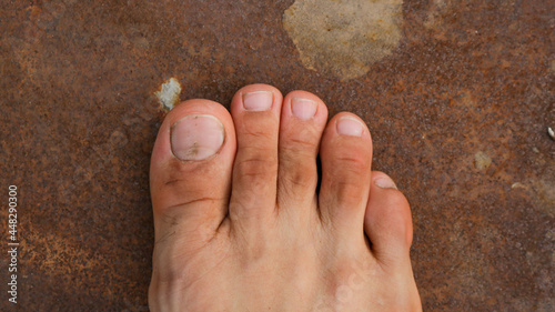 Male Foot with second toe longer than a big toe. Mortons's toe, Greek foot or Royal toe or Aboriginal feet. photo