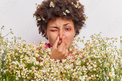 Headshot of curly haired young ethnic woman has problems with breathing holds nose suffers from allergy to camomile holds big bouquet of flowers has red itchy eyes. Allergic reaction on pollen