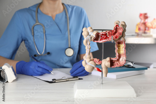 Gastroenterologist with human colon model at table in clinic, closeup photo