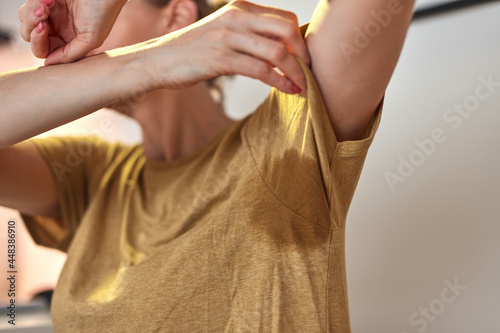 Woman with excessive armpit sweatiness and shirt stain.