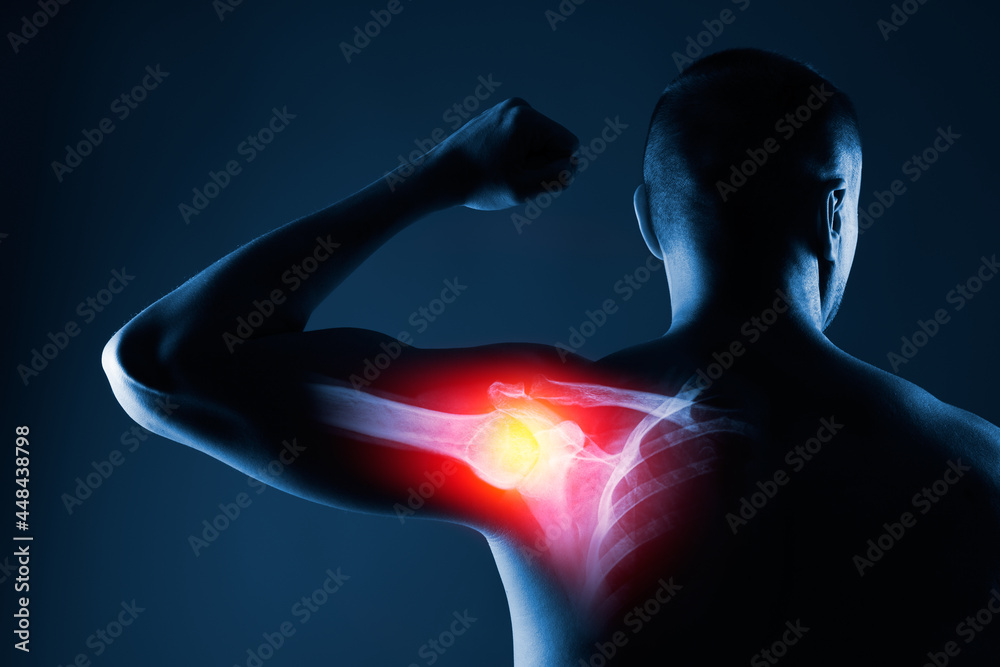 Human shoulder joint in x-ray on blue background. Shoulder joint is highlighted by yellow red colour. - obrazy, fototapety, plakaty 