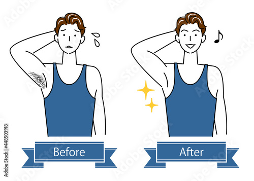 ムダ毛処理 わき毛を脱毛する可愛い男性のビフォーアフター イラスト シンプル ベクター