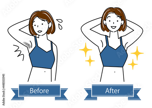 ムダ毛処理 わき毛を脱毛する可愛い女性のビフォーアフター イラスト シンプル ベクター
