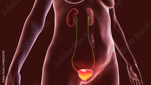 Overactive urinary bladder, 3D illustration photo