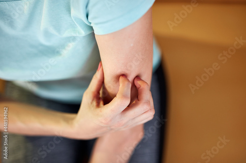 Woman with itchy, tingling arms scratching skin.