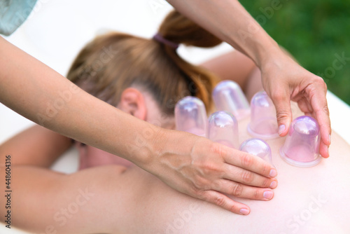 Woman masseur doing massage with vacuum cups on back outdoors. Cupping treatment at spa. Traditional Chinese medicine. 