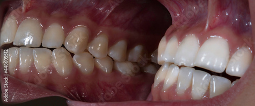 dental fotografia medica