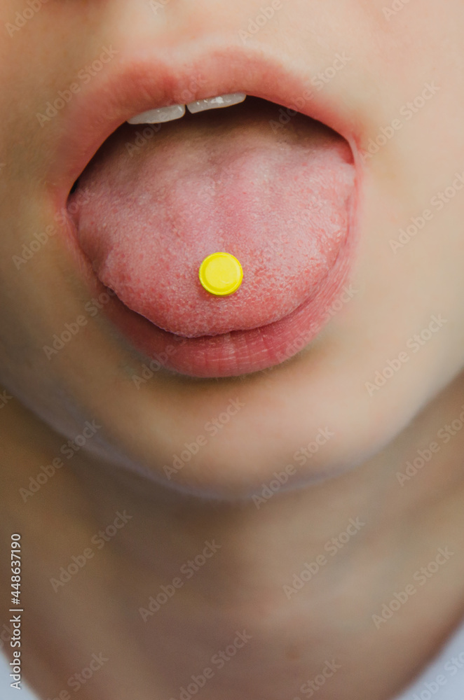 Fototapeta premium the yellow pill lies on the woman's red tongue. mouth close-up. disease and treatment concept. skin
