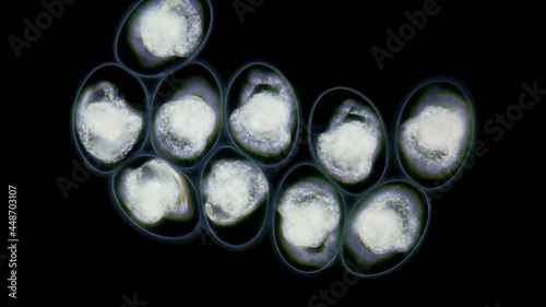 Eggs with Mollusca Nudibranchia embryos under a microscope, possibly Superfamily Fionoidea. They are attached to algae. Next stage, veliger, will float in water column. Barents Sea photo