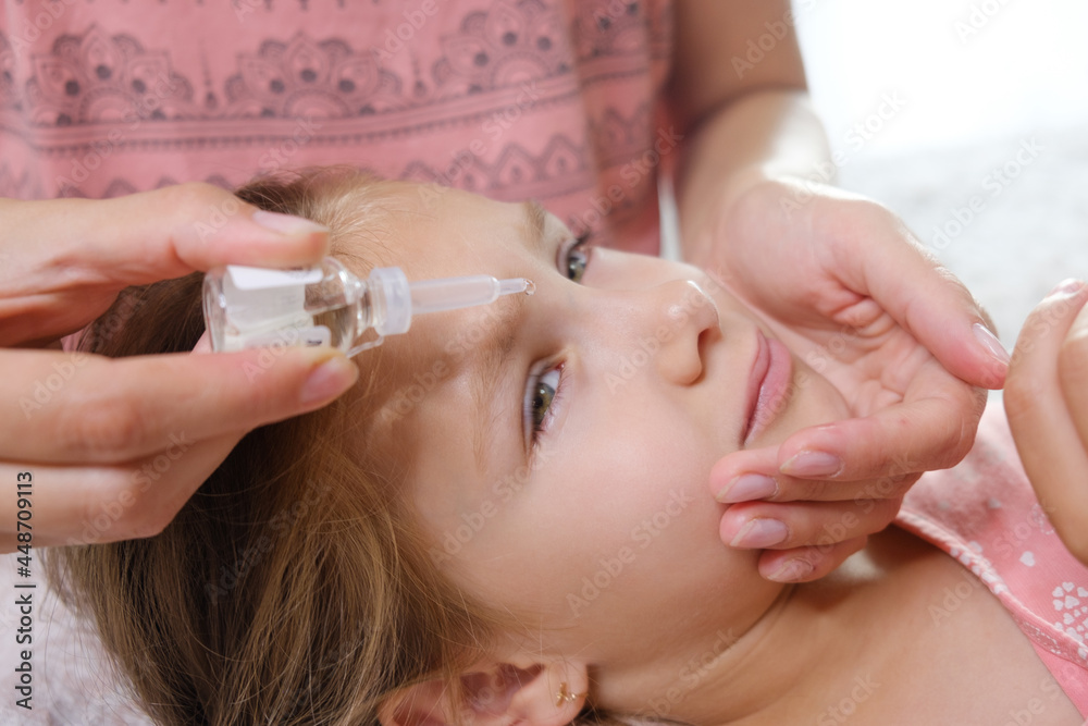 close up mother drips in eyes of the girl a medicinal solution close up mother drips in eyes of the girl a medicinal solution