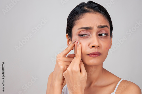 A young woman popping a pimple on her face. photo