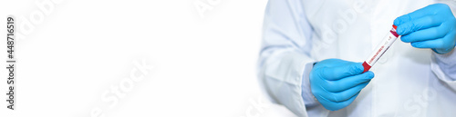 Doctor holding a test blood sample tube positive with strain COVID-19.Banner. Copy space for text