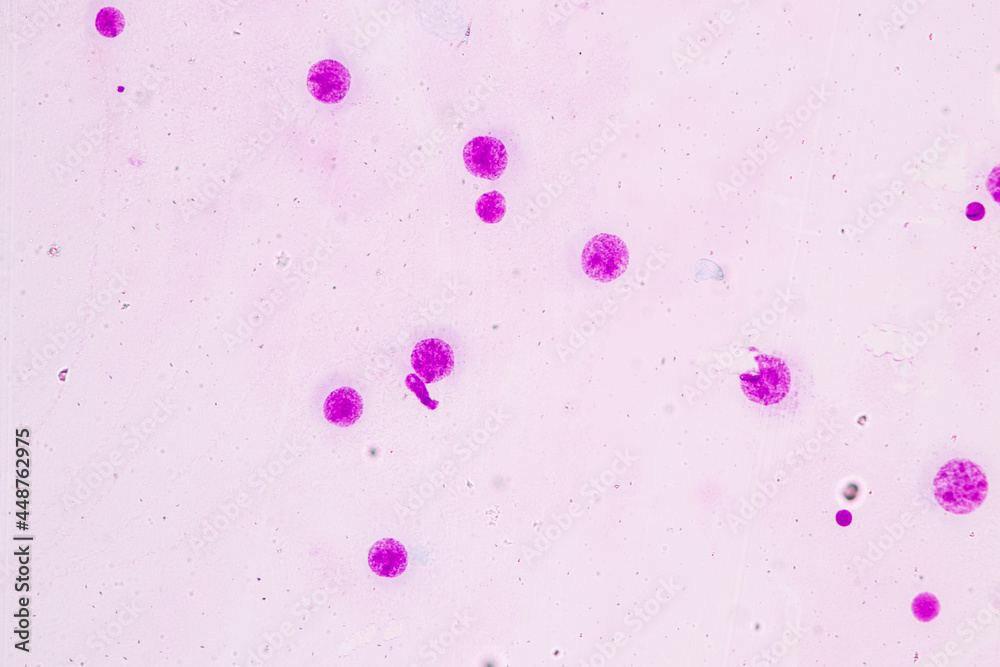 Chromosomes Human under the microscope for education.
Chromosomes Human under the microscope for education.
