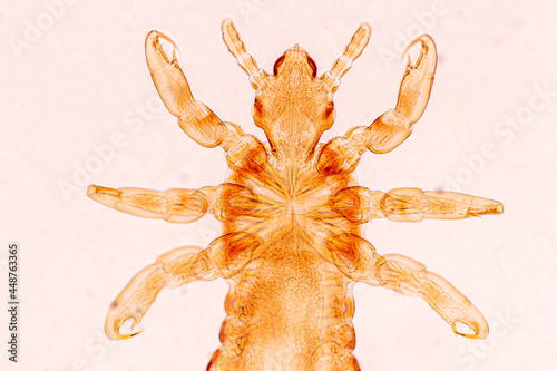 The head louse (Pediculus humanus capitis) is a parasite Live on the body, person or animal and live by sucking blood into food.
 photo