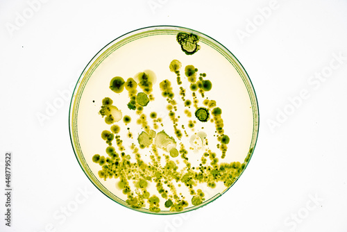 Fotografie Growing Bacteria in Petri Dishes on agar gel Scientific experiment