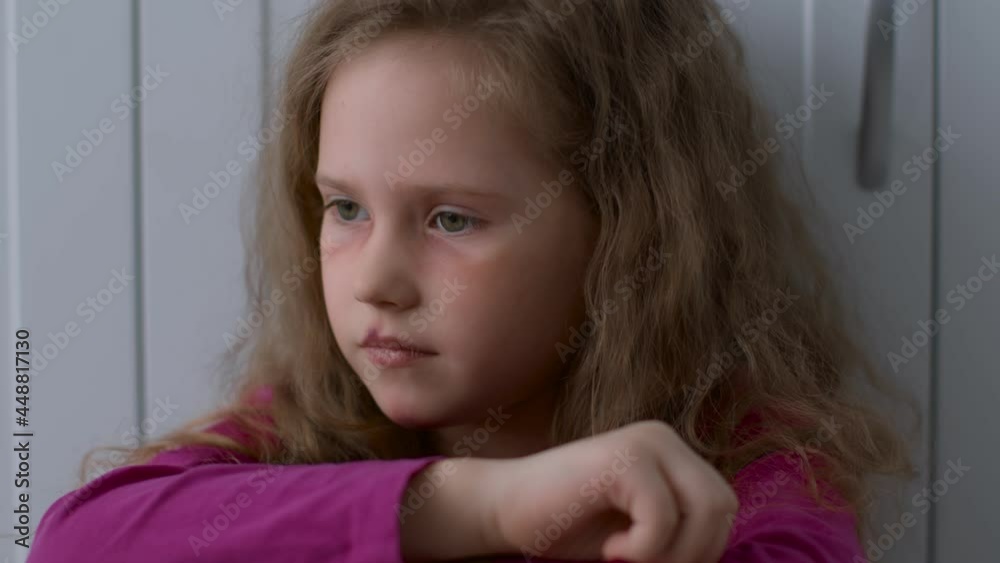 Victim of kids abuse and domestic violence. Close up of scared little girl with battered face sitting alone and crying Victim of kids abuse and domestic violence. Close up of scared little girl with battered face sitting alone and crying
