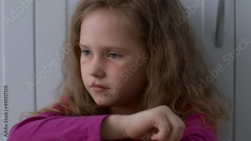 Victim of kids abuse and domestic violence. Close up of scared little girl with battered face sitting alone and crying photo