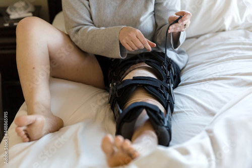 Woman's hands securing straps on orthopedic leg brace.