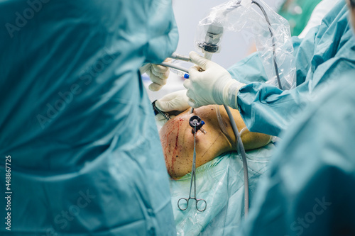 The hands of doctors in an operation



