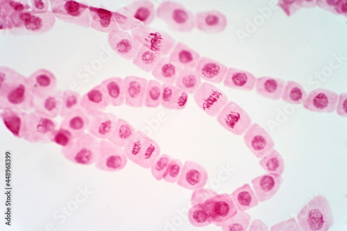 Mitosis cell of root tip of onion under the light microscope.