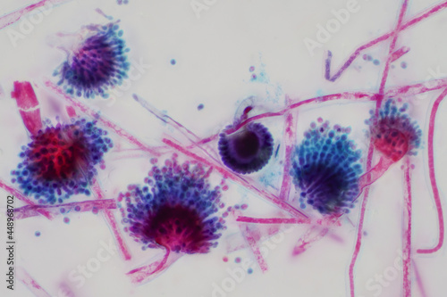 Aspergillus (mold) under the light microscopic view. photo