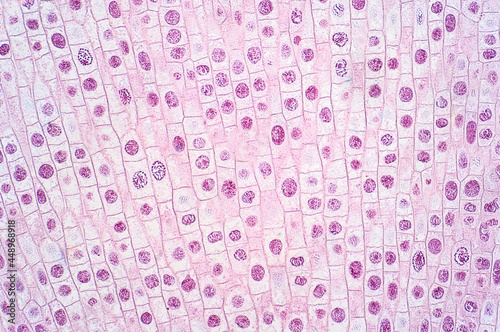 Mitosis cell of root tip of onion under the light microscope. photo